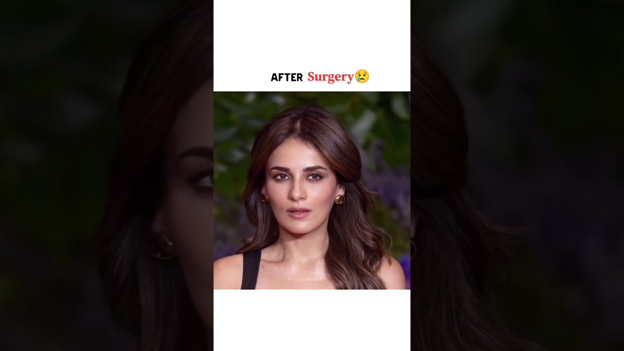Radhika Madan's Post-Surgery Transformation 😢