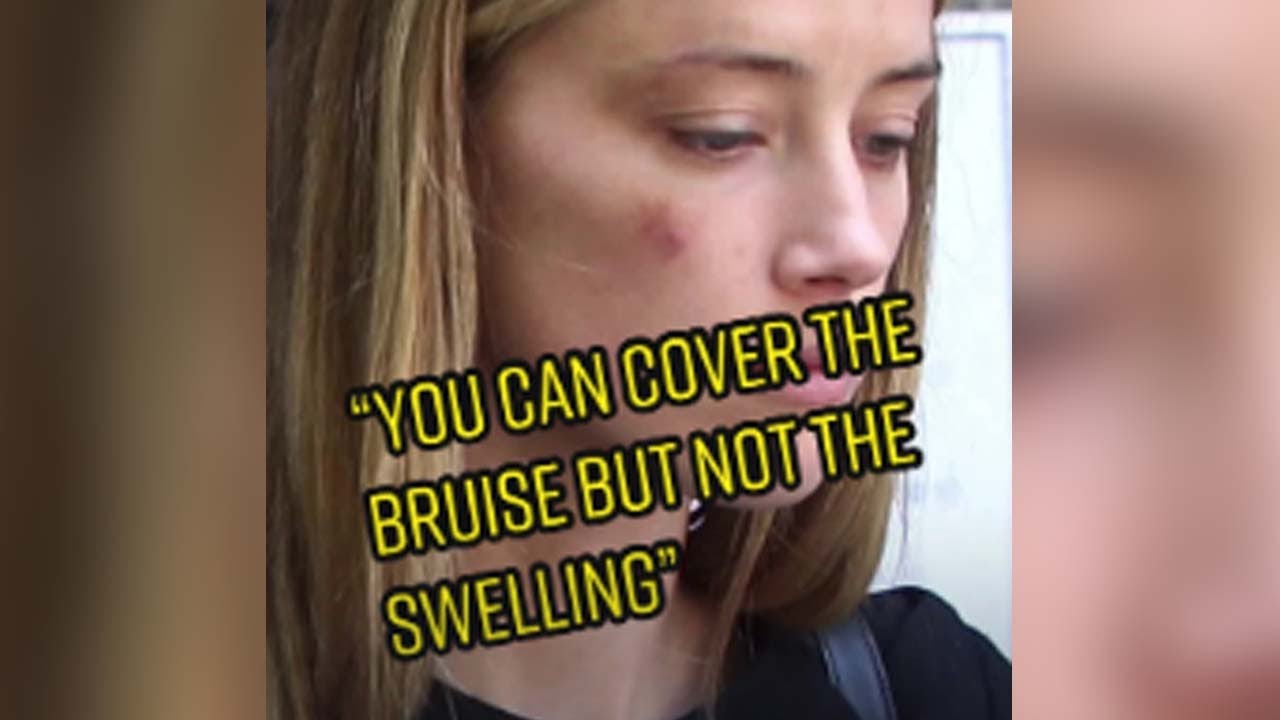 Where's Amber Heard's Bruise? - Witness DIDN'T see any #short