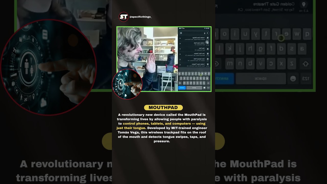 MouthPad: A Revolutionary Device Empowering Paralysis Patients