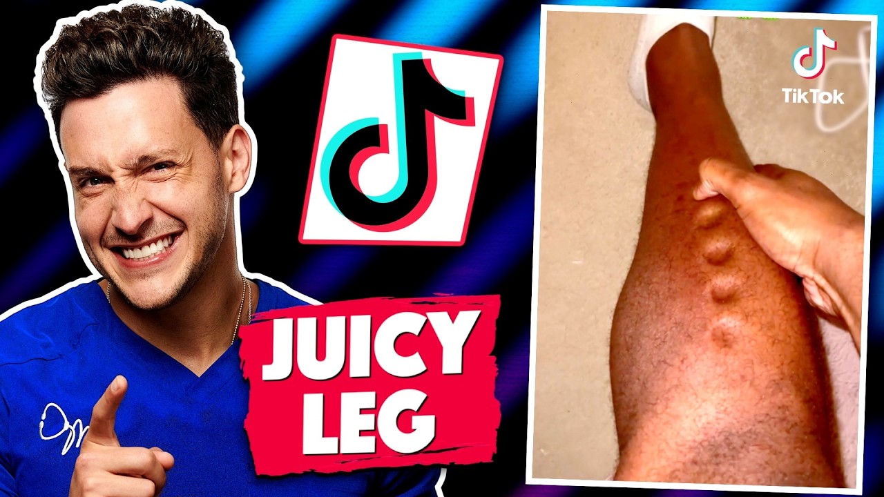 TikTok Trends Your Doctor Warned You About