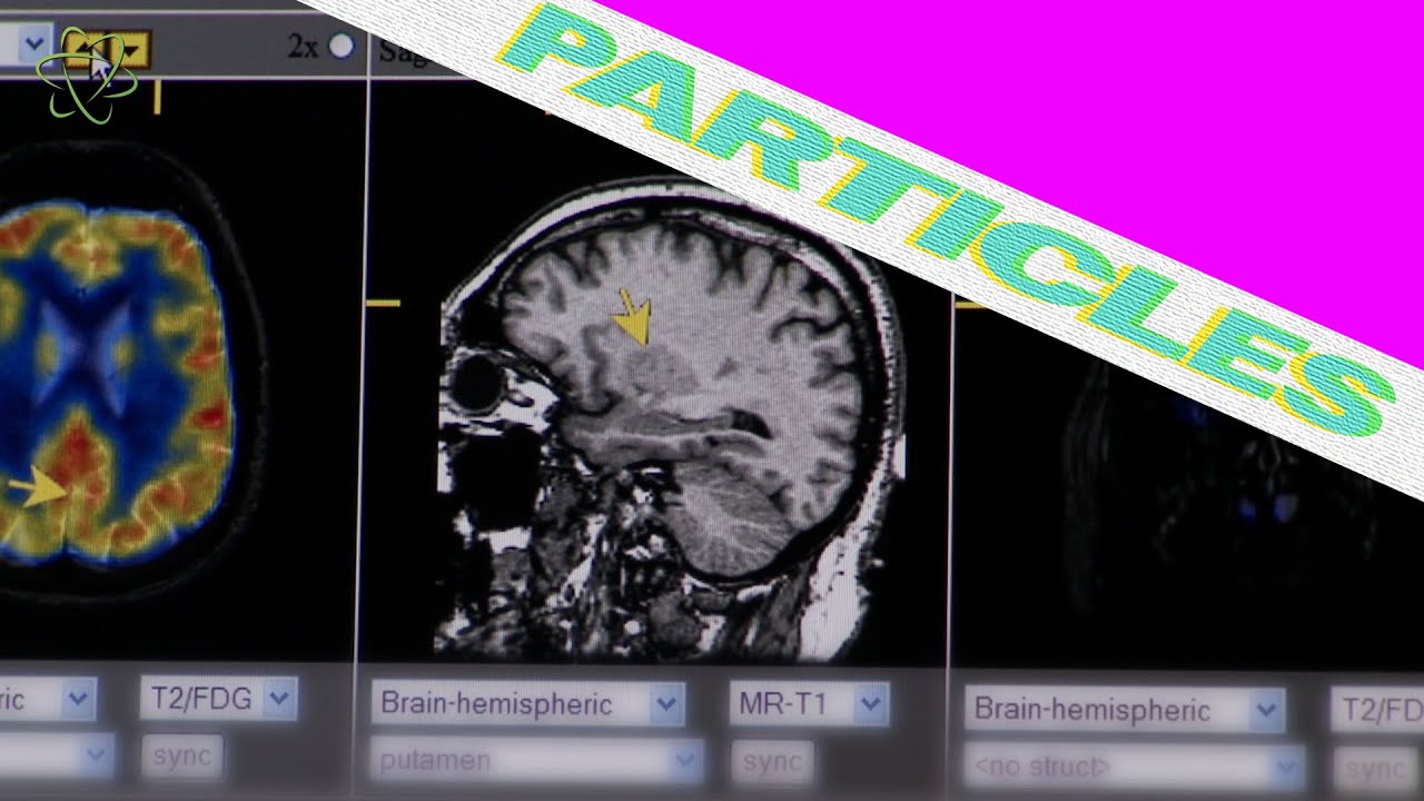 COVID-19 May Cause Brain Shrinkage 🧠