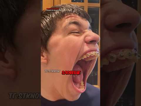 У Него Самый Большой Рот в Мире😱🤯 #рекорд #гиннеса #shorts