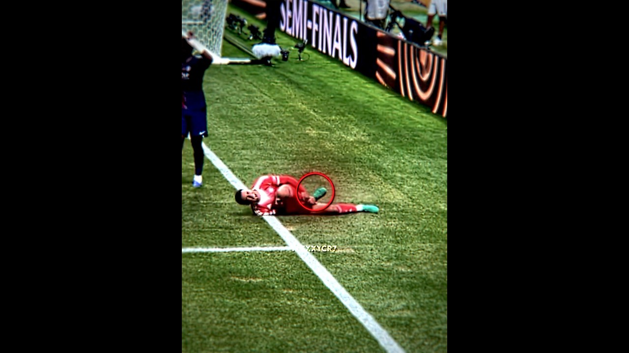 Musiala's Injury: Is His Career Over? 💔