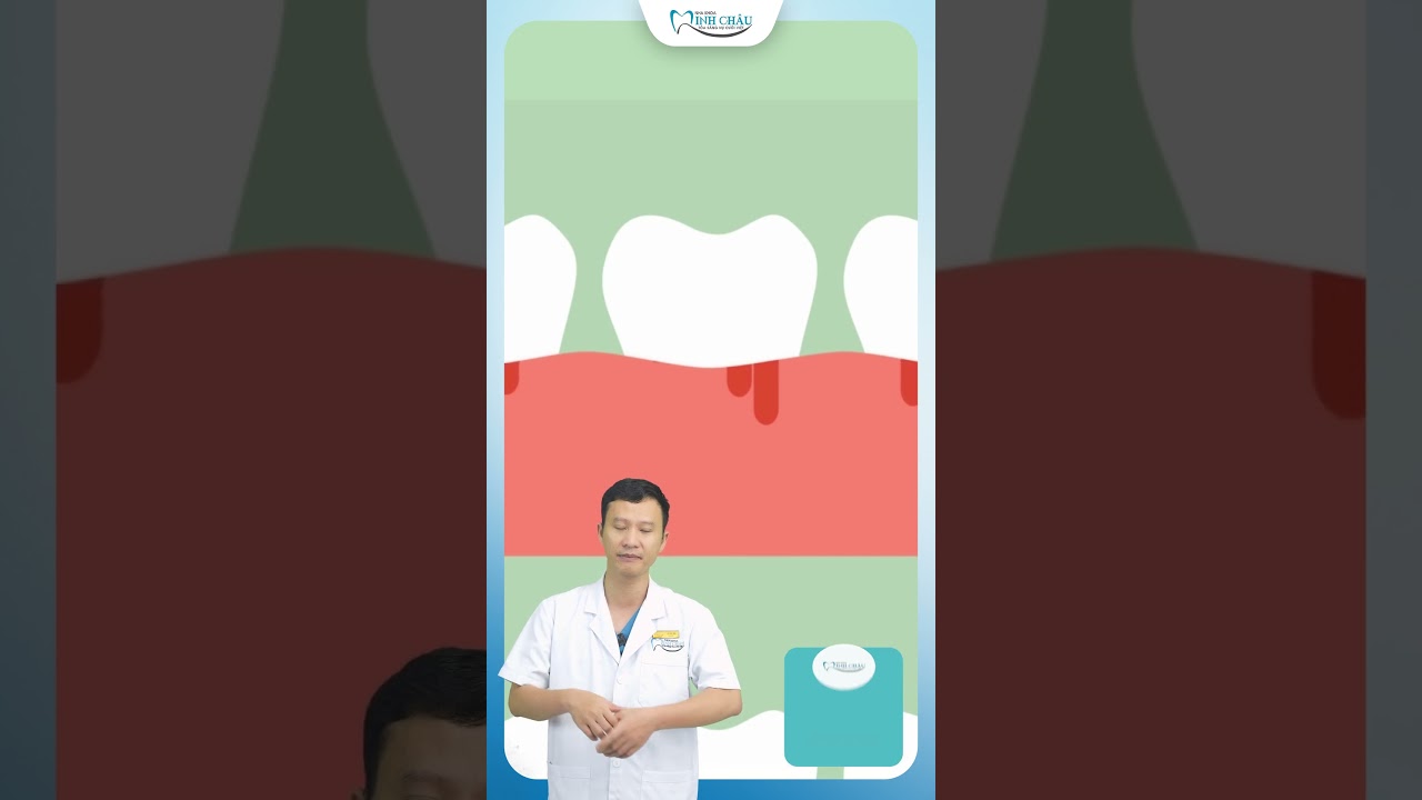 Nguyên Nhân Viêm Lợi, Tụt Lợi, Tiêu Xương | Bác Sĩ Yên