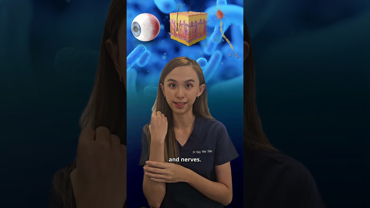 Leprosy Still Exists Today – Don't Delay Diagnosis 🤔