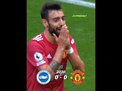 Penalty After the Whistle – Brighton vs Man United.🔥