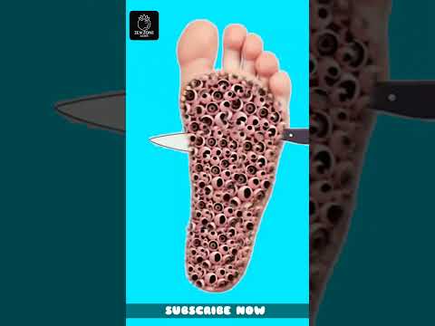 FOOT DEEP CLEANING | ASMR CLEANING VIDEOS | ASMR TREATMENT | BODY CLEANING | ASMR ANIMATION