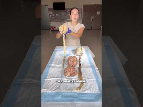 Real human brains! 🧠👀 #anatomy #organs #brains #humanbody #science #scienceteacher #education