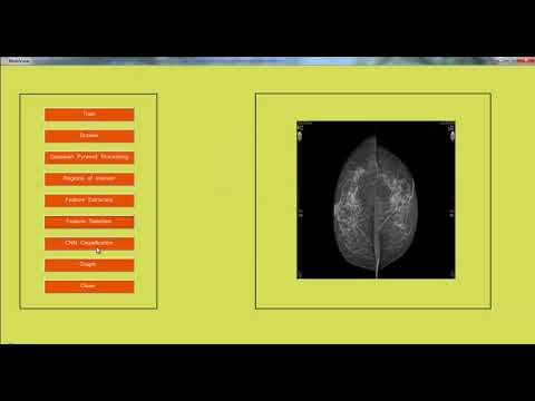 Digital Image Processing Projects & Thesis List ๐ธ