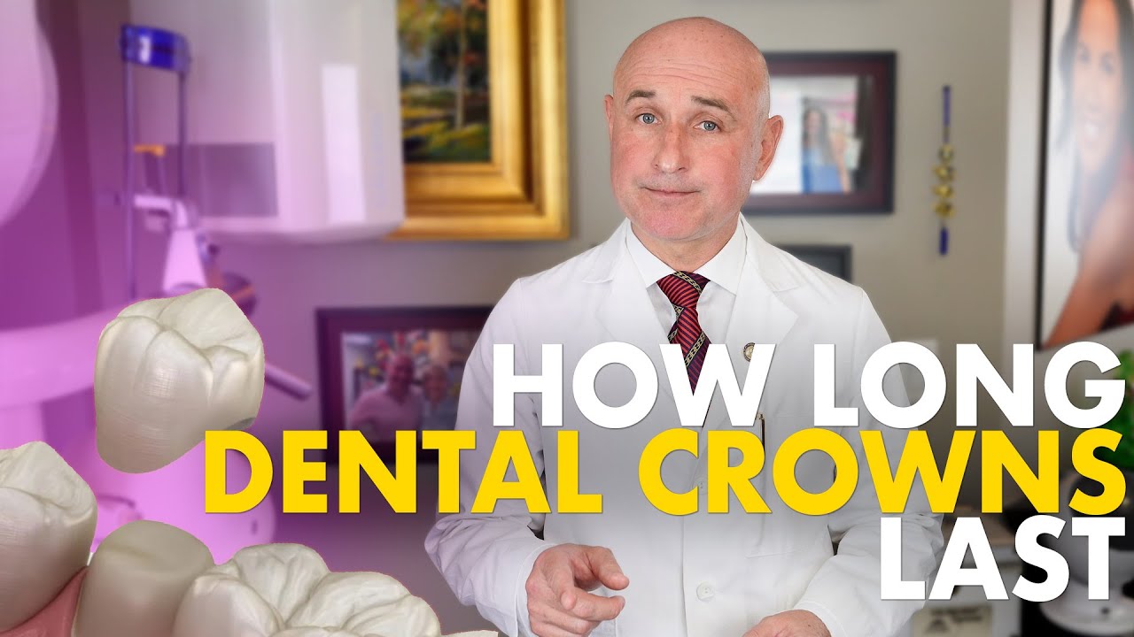 Dental Crowns: Lifespan & Replacement Tips 🦷