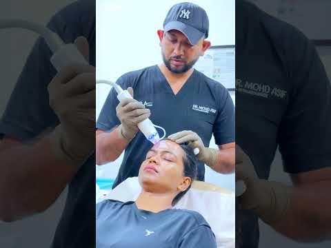 Cara Aesthetics - UltraVac MnRF