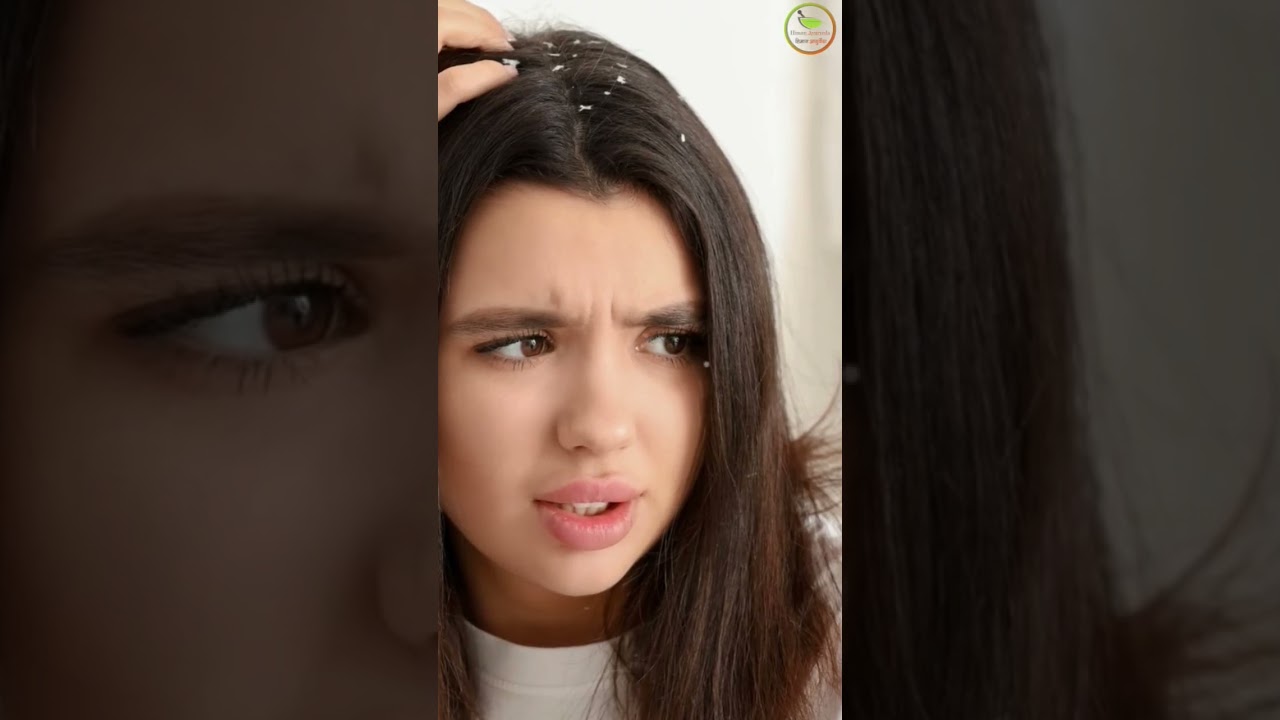 कड़ी पत्ते के अद्भुत फायदे जानिए 🍃 | आयुर्वेदिक उपाय