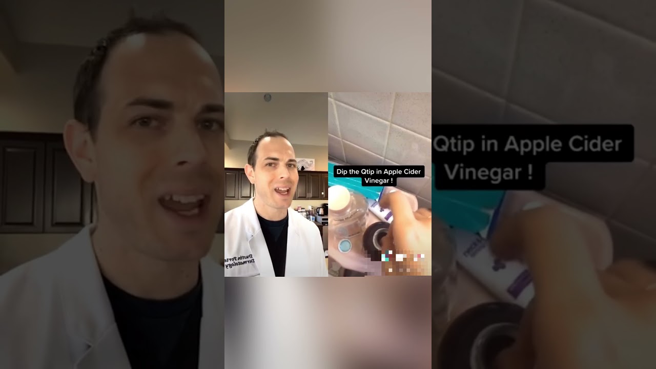 Unsafe Methods to Remove Moles ⚠️