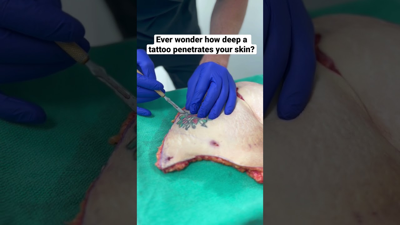 Understanding Tattoo Ink Penetration in Skin