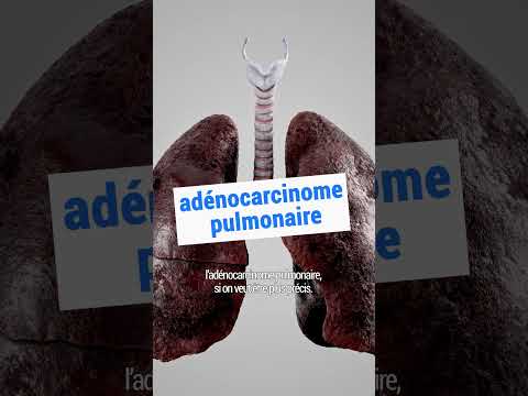 Faut-il interdire les filtres à cigarette ? 🚬 #shorts #rtbf