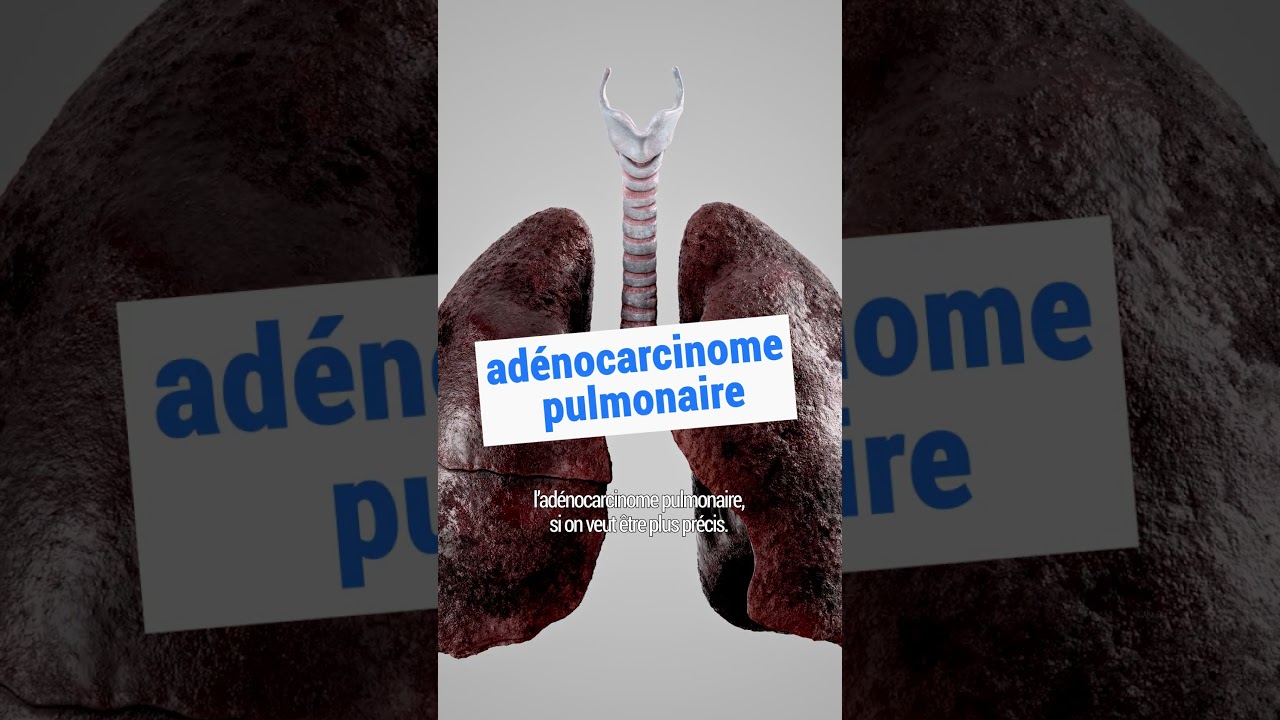 Faut-il interdire les filtres à cigarette ? La vérité sur leur efficacité 🚭