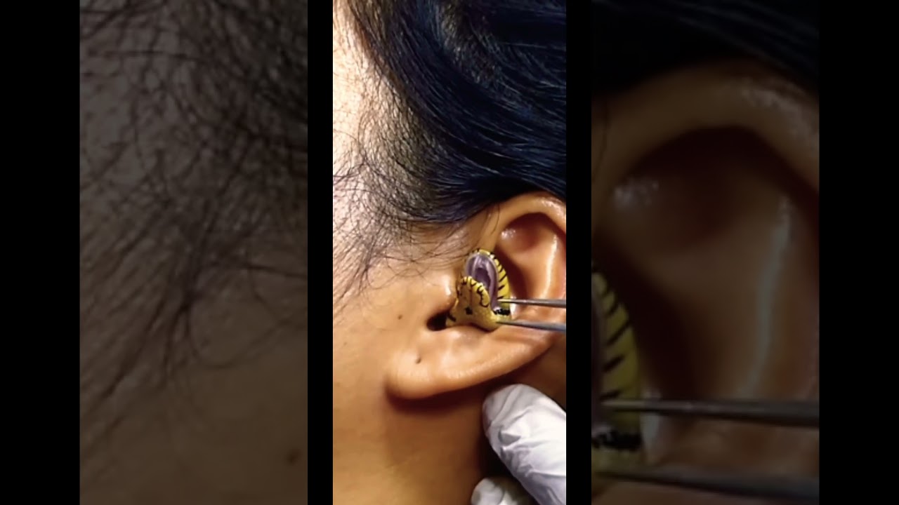 ثعبان في أذن امرأة هندية 🐍