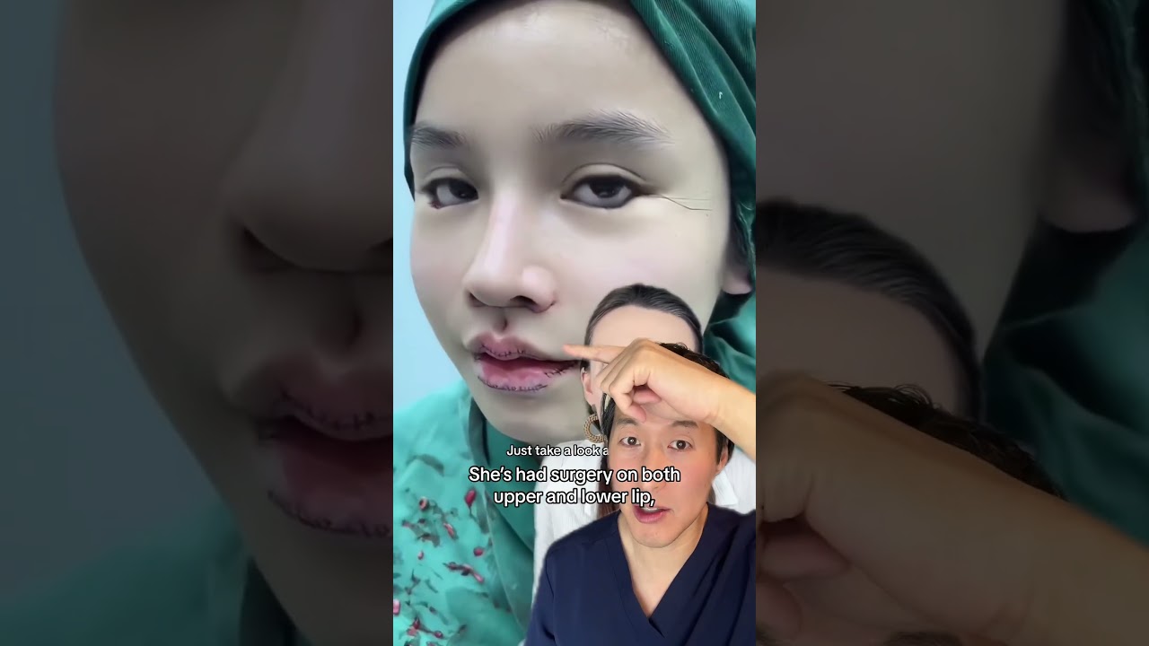 Plastic Surgery: When Is It Too Much? 🤔