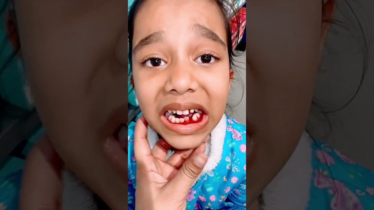 Amaira ke sath kya ho gaya? 😂