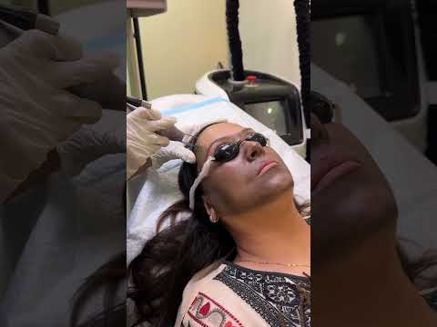 Legendary actress Fazila Qazi visits Dr. Amna’s Clinic for her pigmentation treatment!