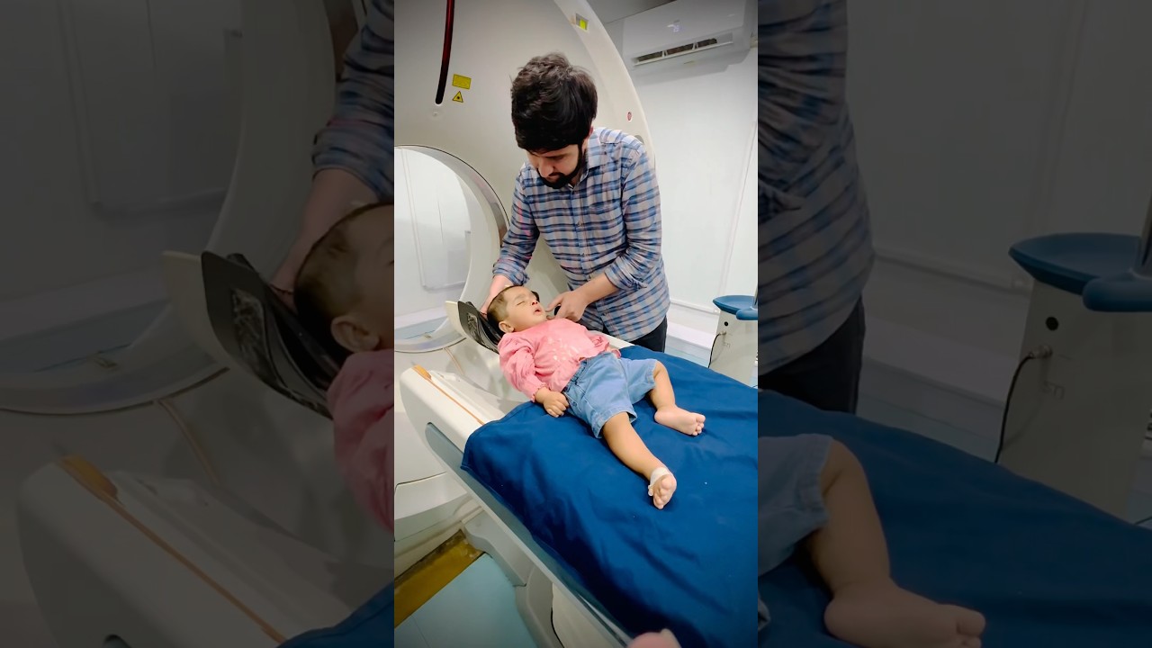 CT PNS Scan Reveals Nasal Mass in 9-Month-Old Baby 🧒 | Pediatric Radiology Case Study