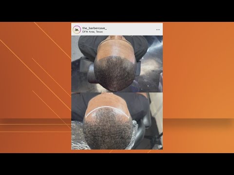Scalp Micropigmentation: Hair Loss Solution in TX 🧑‍🎤