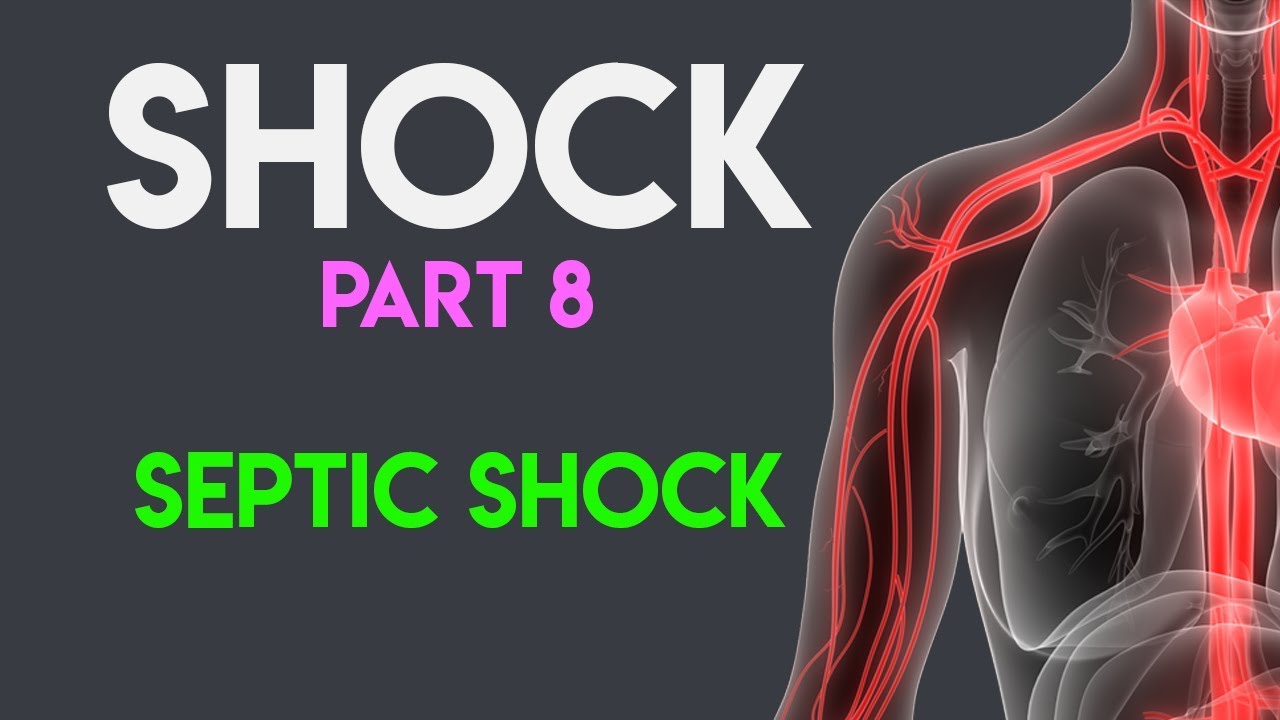 Septic Shock Overview & Critical Care Tips
