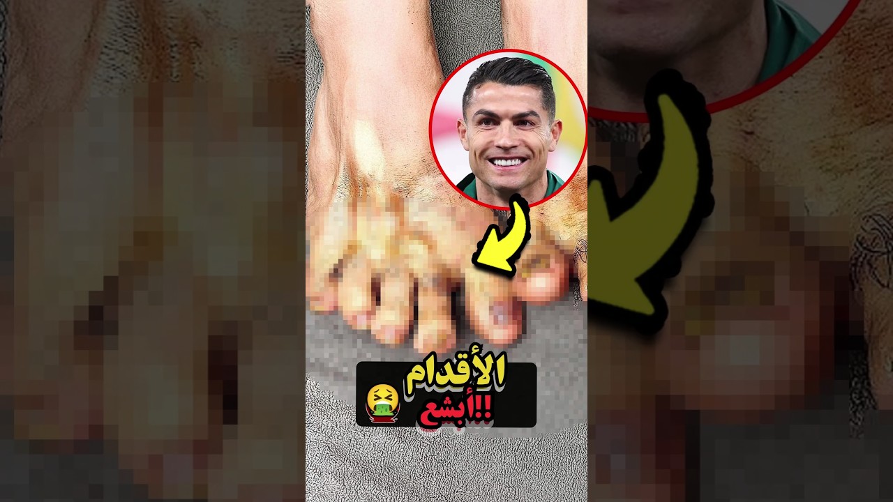 أبشع أقدام لاعبي كرة القدم! 😱