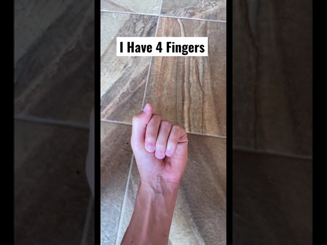 I Only Have 4 Fingers! 😮 | Short & Surprising Reveal