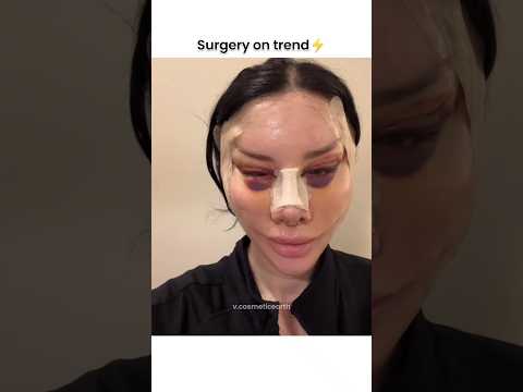 full face surgery😱🔥#shorts #cosmeticsurgery #beauty
