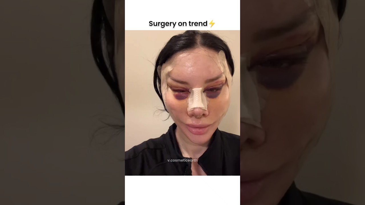 Transform Your Look with Full Face Surgery! 😱✨