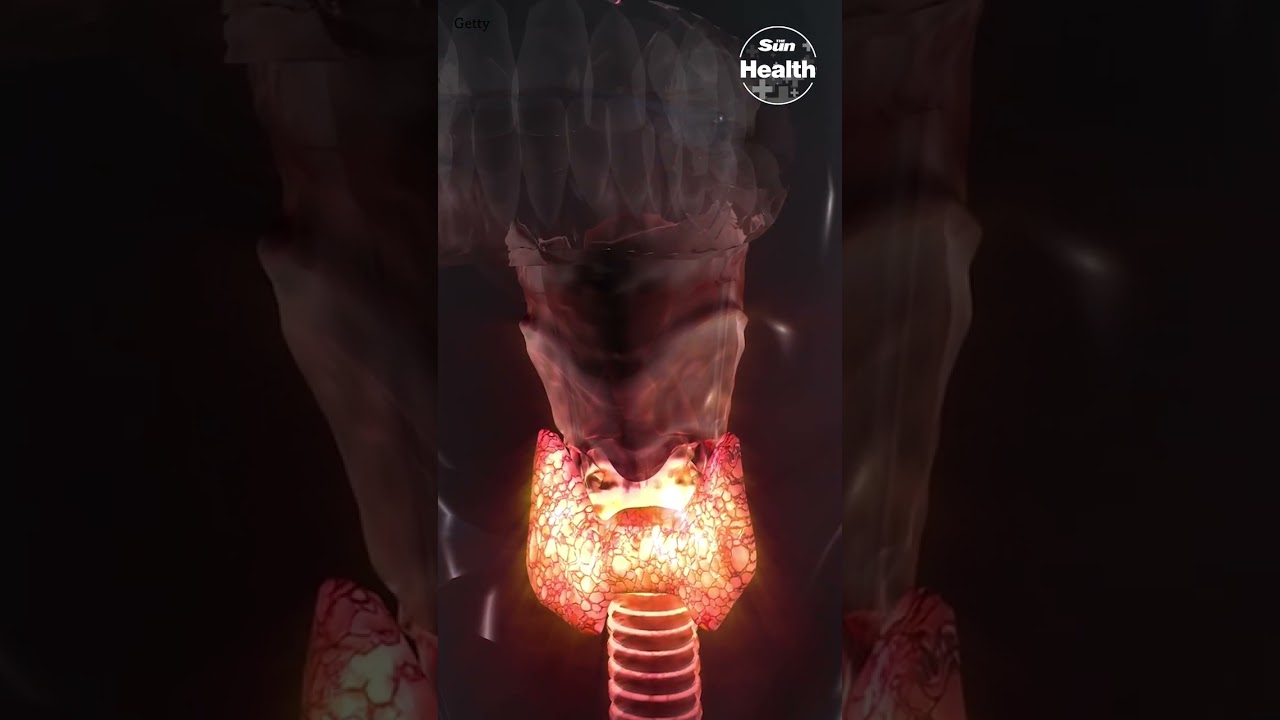 8 Causes of Constant Fatigue π΄