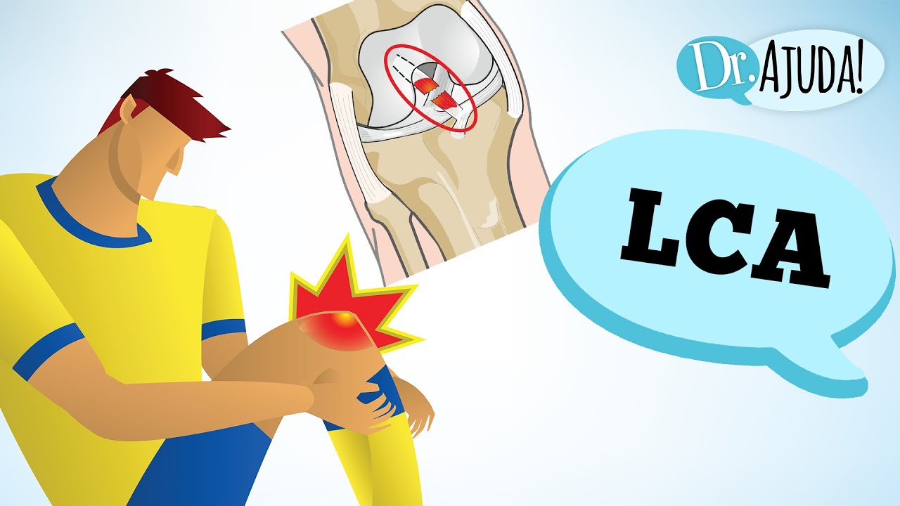 Lesão no Joelho: Entenda o LCA e Seus Sintomas 🦵