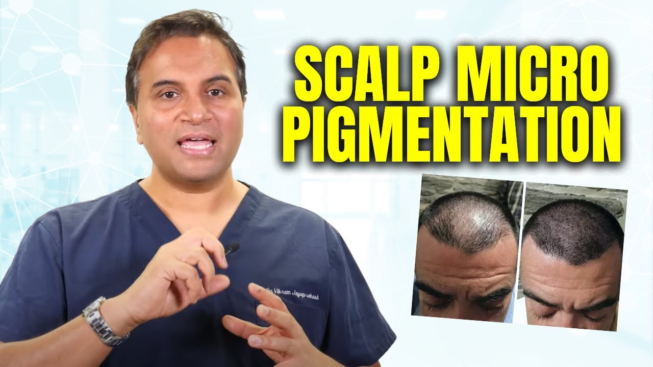 Scalp Micro Pigmentation Explained | The Hair Loss Show