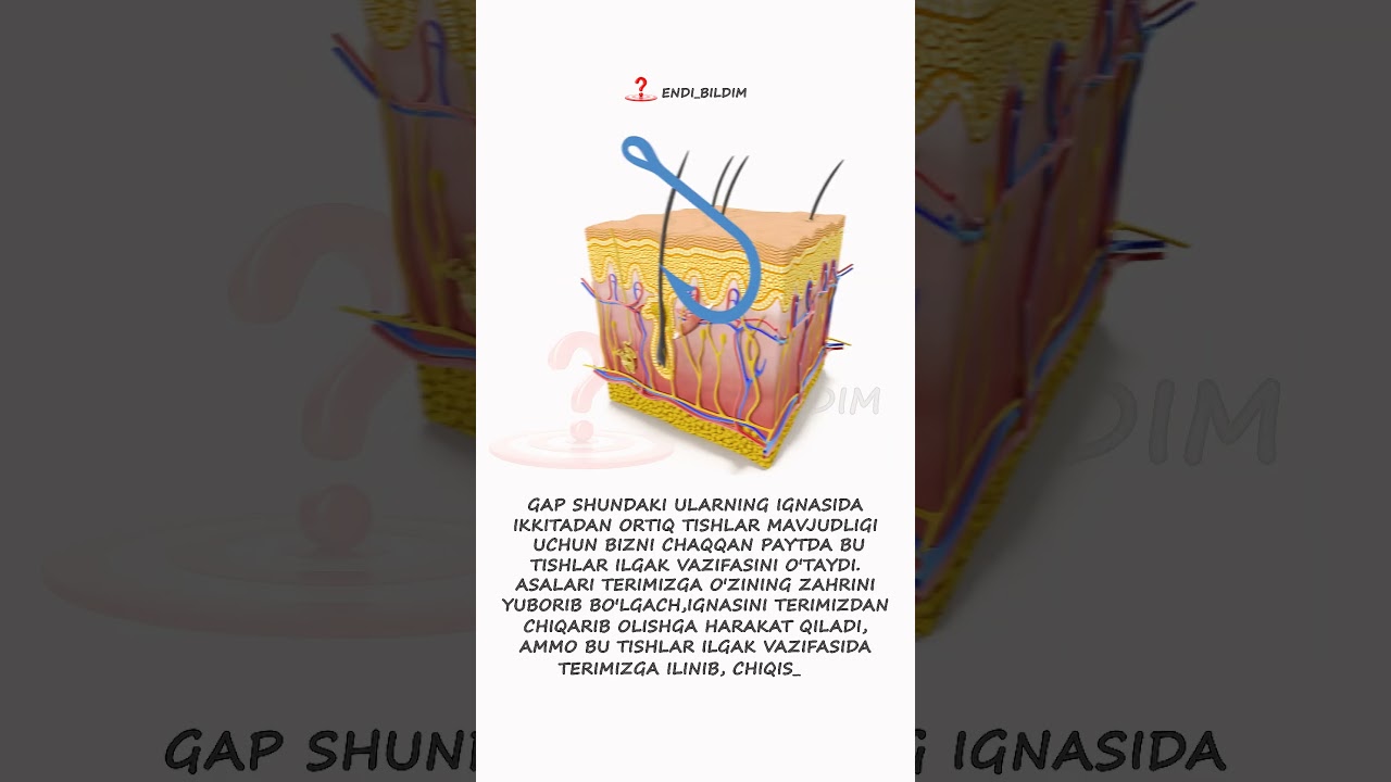 Asalarining bizni chaqishi bilan vafot etishi sabablari 🐝