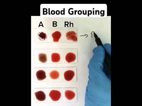 Blood Grouping made easy