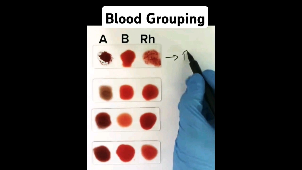 Simplified Blood Grouping Techniques