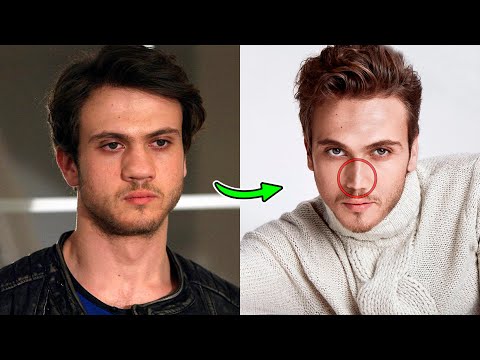 Турецкие актеры которые сделали пластическую операцию. Турецкие актеры до пластики 2022