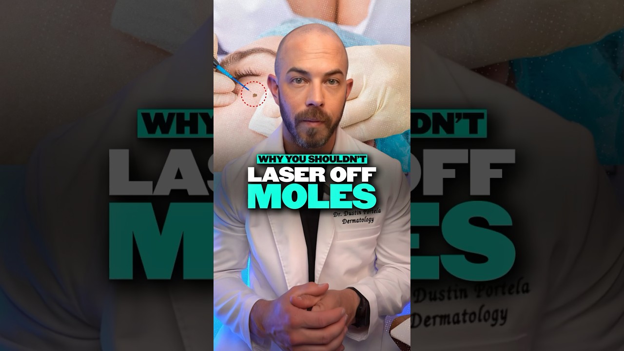 Why Laser Removal of Moles Is a Bad Idea ❌