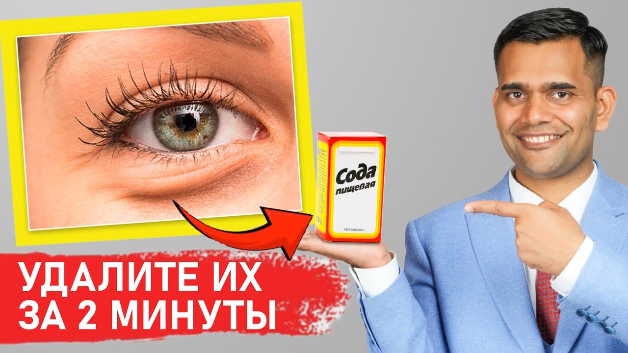 Как избавиться от мешков под глазами 👁️