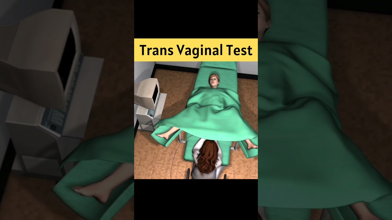 Transvaginal Test Explained for Women 🌸