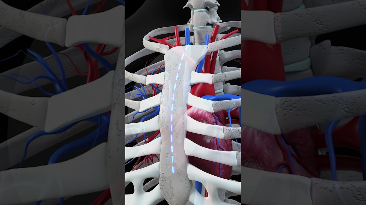 Prof. Dr. Oğuz Yılmaz: Bypass mı Stent mi? 🫀