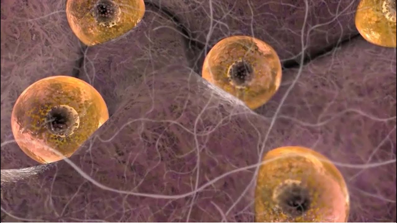 Understanding PCOS: Causes & Treatment Options