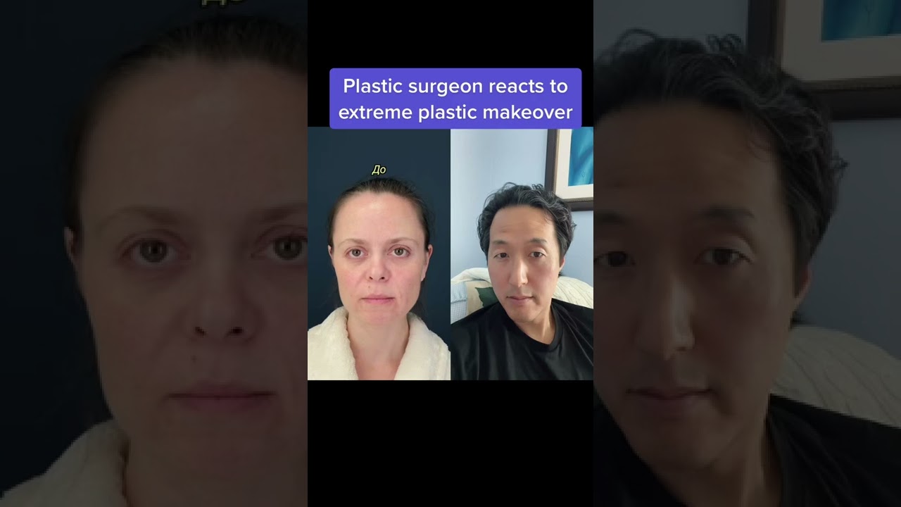 Surgeon Reacts to Extreme Plastic Makeover ✨