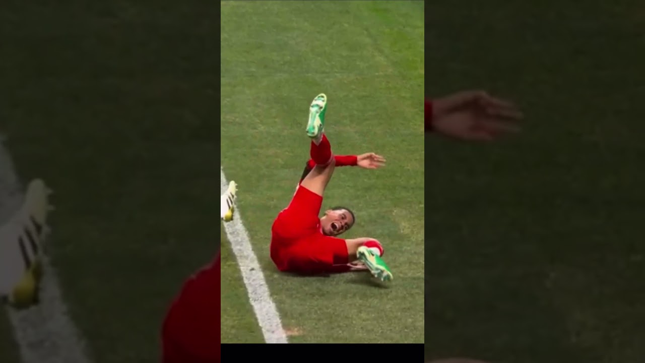 Jamal Musiala Sidelined Due to Injury ⚽