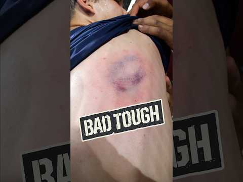 BEANED by 98 mph…TWICE IN ONE AT BAT?! 😱🤯