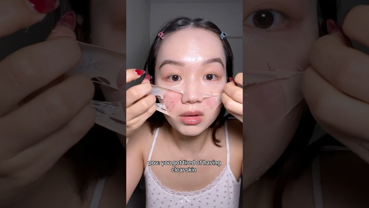 Who wants clear skin anyway? 🥱#acne #clearskin #viral