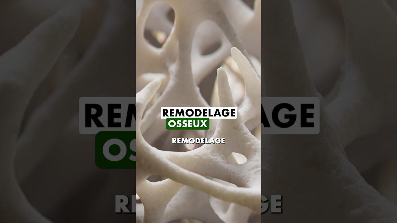 Comprendre l’ostéoporose : causes, risques et prévention