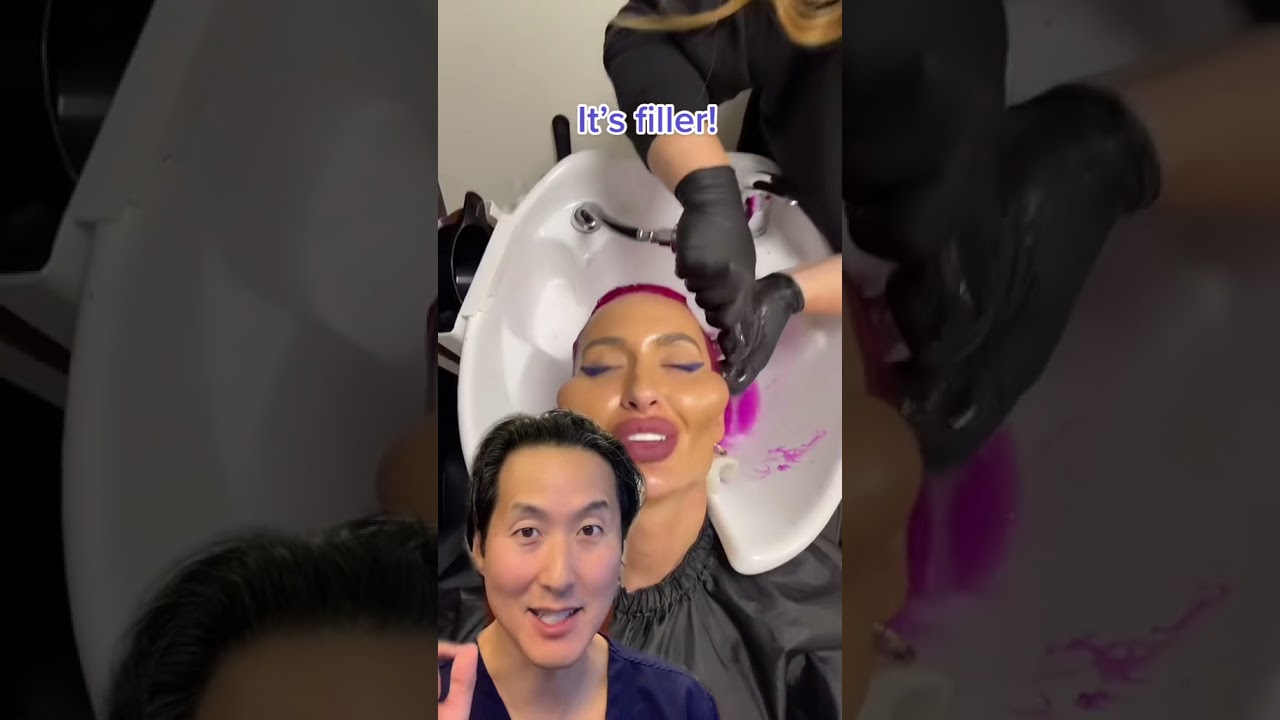 Cheek Filler or Implants? A Plastic Surgeon Reacts! #shorts #cheekfiller