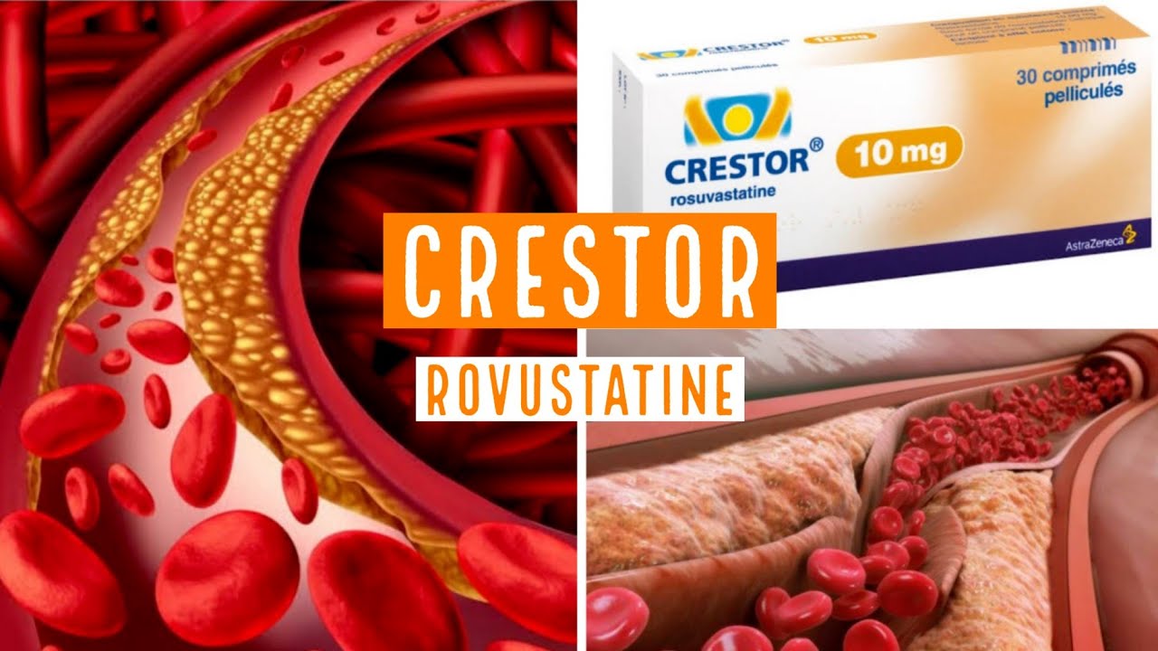 CRESTOR (Rovustatine) 5mg ,10mg , 20mg